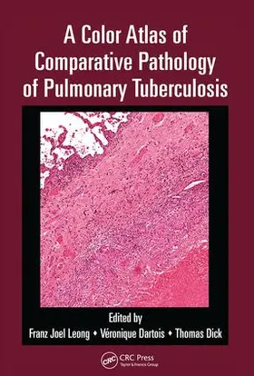 Leong / Dartois / Dick | A Color Atlas of Comparative Pathology of Pulmonary Tuberculosis | Buch | 978-1-138-45199-5 | sack.de