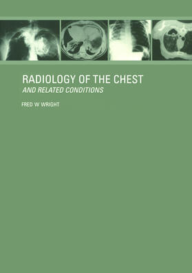 Wright | Radiology of the Chest and Related Conditions | Buch | 978-1-138-46493-3 | sack.de