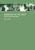 Wright |  Radiology of the Chest and Related Conditions | Buch |  Sack Fachmedien