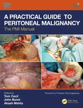 Cecil / Bunni / Mehta |  A Practical Guide to Peritoneal Malignancy | Buch |  Sack Fachmedien