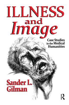 Gilman |  Illness and Image | Buch |  Sack Fachmedien