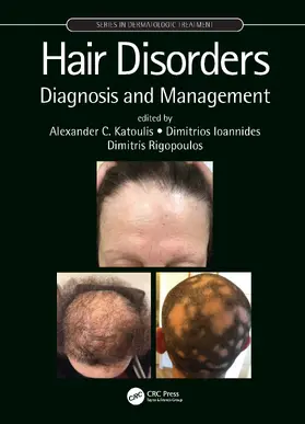 Katoulis / Ioannides / Rigopoulos |  Hair Disorders | Buch |  Sack Fachmedien