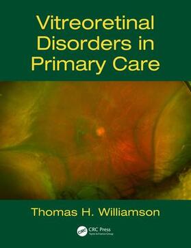 Williamson | Williamson, T: Vitreoretinal Disorders in Primary Care | Buch | 978-1-138-62811-3 | sack.de