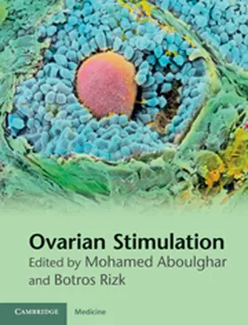 Aboulghar / Rizk |  Ovarian Stimulation | eBook | Sack Fachmedien