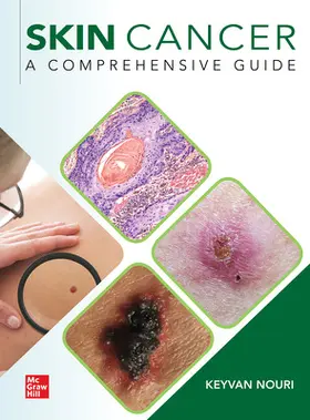 Nouri |  Skin Cancer: A Comprehensive Guide | Buch |  Sack Fachmedien