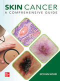 Nouri |  Skin Cancer: A Comprehensive Guide | Buch |  Sack Fachmedien