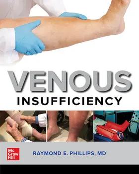 Phillips |  Venous Insufficiency | Buch |  Sack Fachmedien