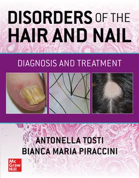 Tosti / Piraccini |  Disorders of the Hair and Nail: Diagnosis and Treatment | Buch |  Sack Fachmedien