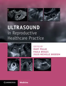 Pillai / Briggs / Bridson | Ultrasound in Reproductive Healthcare Practice | Buch | 978-1-316-60973-6 | sack.de