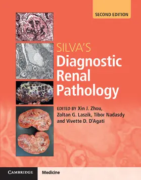 Zhou / Laszik / Nadasdy |  Silva's Diagnostic Renal Pathology | Buch |  Sack Fachmedien