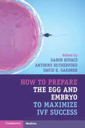 Kovacs / Rutherford / Gardner | How to Prepare the Egg and Embryo to Maximize Ivf Success | Buch | 978-1-316-62177-6 | sack.de