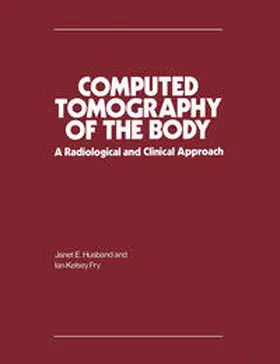 Husband / Fry |  Computed Tomography of the Body | eBook | Sack Fachmedien