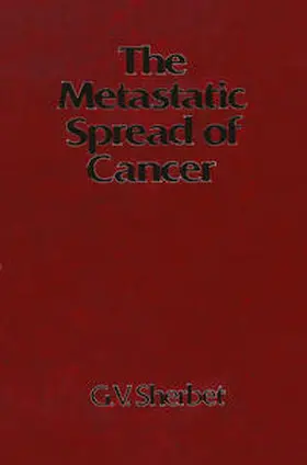 Sherbet |  Metastatic Spread of Cancer | eBook | Sack Fachmedien