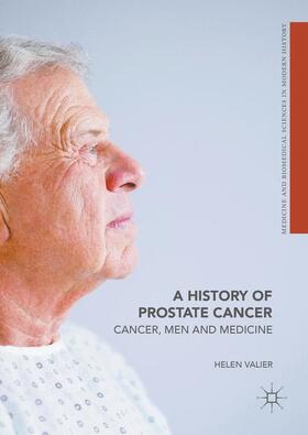 Valier |  A History of Prostate Cancer | Buch |  Sack Fachmedien