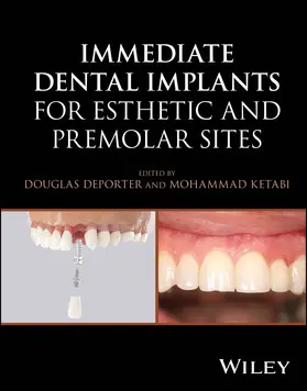 Deporter / Ketabi |  Immediate Dental Implants for Esthetic and Premolar Sites | Buch |  Sack Fachmedien