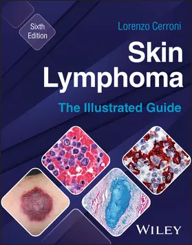 Cerroni |  Skin Lymphoma | Buch |  Sack Fachmedien