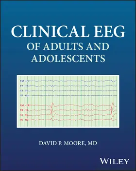 Moore |  Clinical Eeg of Adults and Adolescents | Buch |  Sack Fachmedien
