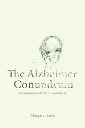 Lock |  The Alzheimer Conundrum | eBook | Sack Fachmedien