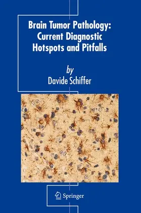 Schiffer |  Brain Tumor Pathology | Buch |  Sack Fachmedien