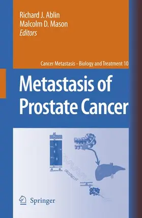Ablin / Mason | Metastasis of Prostate Cancer | Buch | 978-1-4020-5846-2 | www.sack.de