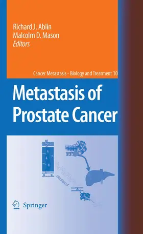 Ablin / Mason | Metastasis of Prostate Cancer | E-Book | www.sack.de