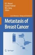 Mansel / Fodstad / Jiang |  Metastasis of Breast Cancer | Buch |  Sack Fachmedien