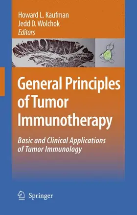 Kaufman / Wolchok |  General Principles of Tumor Immunotherapy | Buch |  Sack Fachmedien