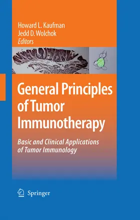 Kaufman / Wolchok |  General Principles of Tumor Immunotherapy | eBook | Sack Fachmedien