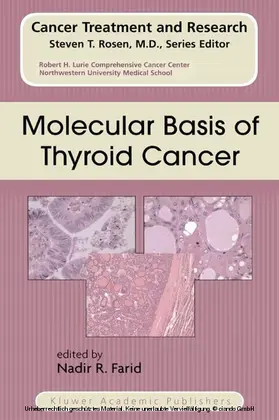 FARID | Molecular Basis of Thyroid Cancer | E-Book | sack.de