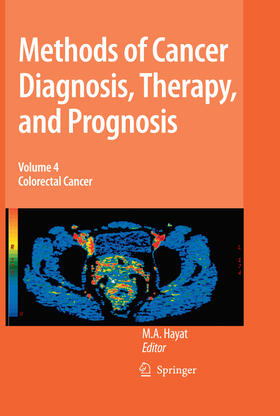 Hayat |  Methods of Cancer Diagnosis, Therapy and Prognosis | eBook | Sack Fachmedien