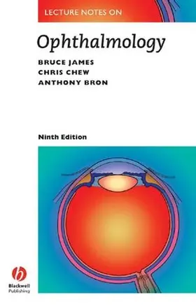 Chew / James |  Lecture Notes on Ophthalmology | Buch |  Sack Fachmedien