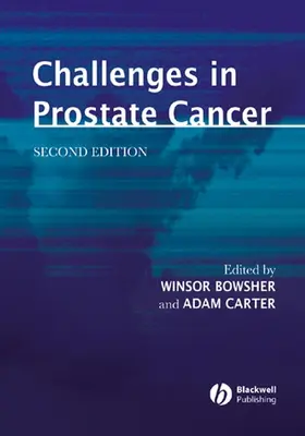 Bowsher / Carter |  Challenges in Prostate Cancer | Buch |  Sack Fachmedien