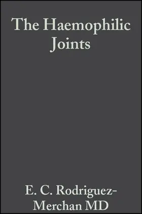 Rodríguez-Merchán | The Haemophilic Joints | Buch | 978-1-4051-1230-7 | www.sack.de