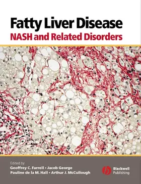 Farrell / George / Hall |  Fatty Liver Disease | Buch |  Sack Fachmedien