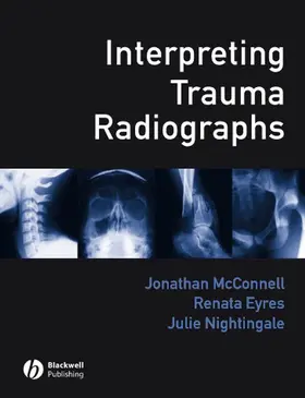 McConnell / Eyres / Nightingale |  Interpreting Trauma Radiographs | Buch |  Sack Fachmedien
