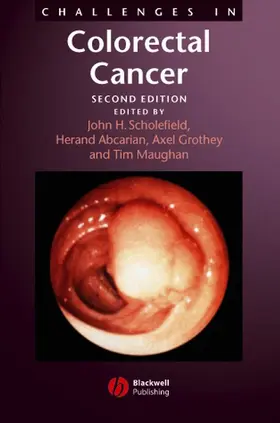 Scholefield / Abcarian / Maughan |  Challenges in Colorectal Cancer 2e | Buch |  Sack Fachmedien
