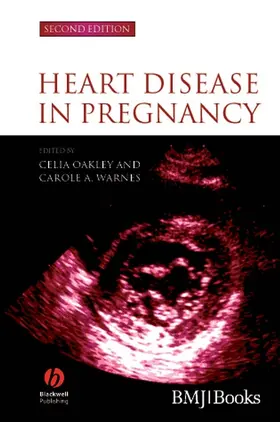 Oakley / Warnes |  Heart Disease in Pregnancy | Buch |  Sack Fachmedien