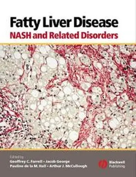 Farrell / George / Hall |  Fatty Liver Disease | eBook | Sack Fachmedien