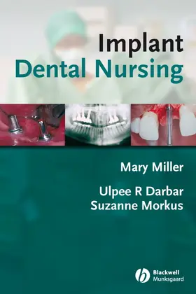 Miller / Darbar / Morkus |  Implant Dental Nursing | Buch |  Sack Fachmedien