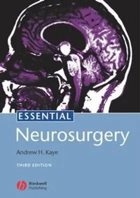 Kaye |  Essential Neurosurgery | eBook | Sack Fachmedien