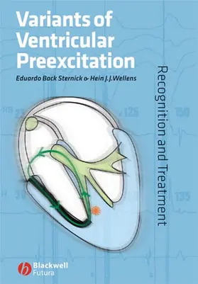 Back Sternick / Wellens |  Variants of Ventricular Preexcitation | Buch |  Sack Fachmedien