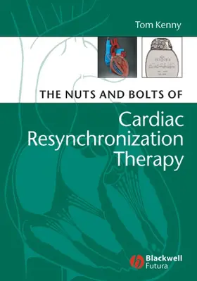 Kenny |  Nuts and Bolts of Cardiac | Buch |  Sack Fachmedien