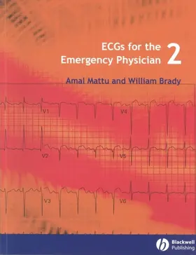 Mattu / Brady |  Ecgs for the Emergency Physician 2 | Buch |  Sack Fachmedien