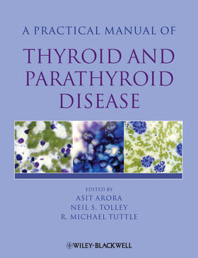 Arora / Tolley / Tuttle | A Practical Manual of Thyroid and Parathyroid Disease | Buch | 978-1-4051-7034-5 | sack.de