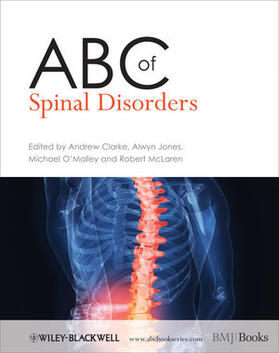 Clarke / Jones / O'Malley | ABC of Spinal Disorders | Buch | 978-1-4051-7069-7 | sack.de