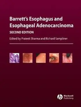 Sharma / Sampliner | Barrett's Esophagus and Esophageal Adenocarcinoma | E-Book | sack.de