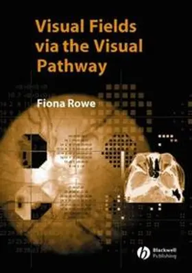 Rowe |  Visual Fields via the Visual Pathway | eBook | Sack Fachmedien