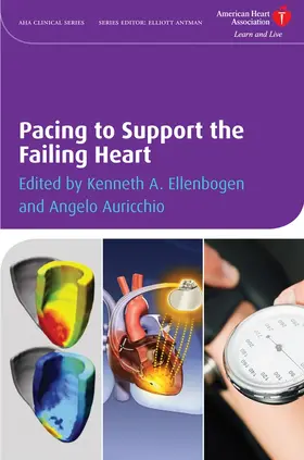 Ellenbogen / Auricchio |  Pacing to Support the Failing Heart | Buch |  Sack Fachmedien