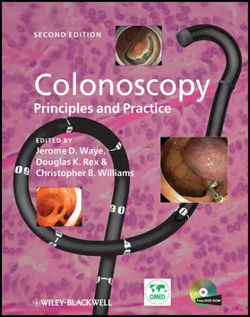Waye / Rex / Williams | Colonoscopy | Buch | 978-1-4051-7599-9 | www.sack.de