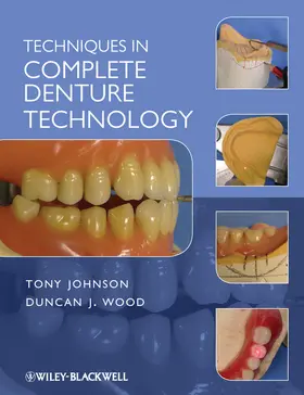 Wood / Johnson |  Techniques in Complete Denture | Buch |  Sack Fachmedien